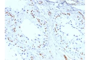 ABIN6383829 to WT1 was successfully used to stain nuclei in sections of human mesothelioma and in human and rat testis sections. (Recombinant WT1 antibody)