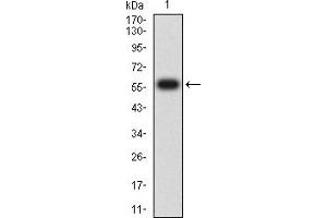 Western blot analysis using CD1C mAb against human CD1C (AA: extra 18-302) recombinant protein.