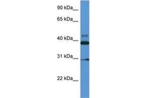 Image no. 1 for anti-Vasodilator-Stimulated phosphoprotein (VASP) (AA 127-176) antibody (ABIN6746957) (VASP antibody  (AA 127-176))