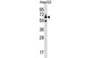 Western Blotting (WB) image for anti-gamma-Glutamyltransferase 2 (gGT2) antibody (ABIN2996985)