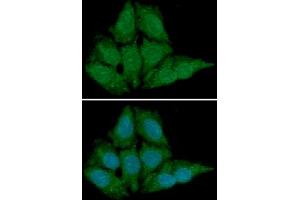 ICC/IF analysis of BLyS in HeLa cells line, stained with DAPI (Blue) for nucleus staining and monoclonal anti-human BLyS antibody (1:100) with goat anti-mouse IgG-Alexa fluor 488 conjugate (Green) (BAFF antibody)