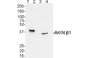 Image no. 1 for anti-SNF1-Related Protein Kinase Regulatory Subunit beta-1 (AKINBETA1) (Regulatory Subunit beta) antibody (ABIN488525) (AKINB1 antibody  (Regulatory Subunit beta))