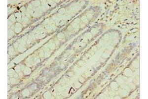 Immunohistochemistry of paraffin-embedded human colon tissue using ABIN7149543 at dilution of 1:100 (CRADD antibody  (AA 1-199))
