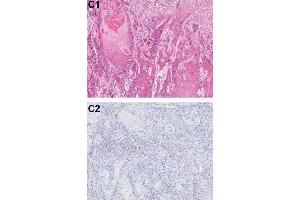 Immunohistochemistry (IHC) image for anti-Programmed Cell Death 4 (PDCD4) (pSer457) antibody (ABIN129708)