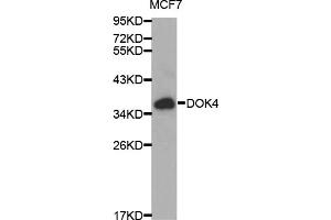 Western blot analysis of extracts of MCF-7 cells, using DOK4 antibody (ABIN5970056) at 1/1000 dilution.