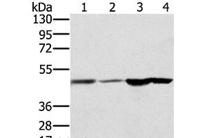 Western Blot analysis of Human fetal brain and normal liver tissue, Human normal kidney tissue and hepg2 cell using RNH1 Polyclonal Antibody at dilution of 1:400 (RNH1 antibody)