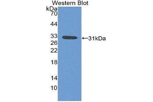 Western Blotting (WB) image for anti-Ficolin (Collagen/fibrinogen Domain Containing) 1 (FCN1) (AA 25-279) antibody (ABIN3207864) (FCN1 antibody  (AA 25-279))