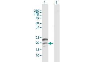 Western Blot analysis of CGB expression in transfected 293T cell line by CGB MaxPab polyclonal antibody. (CGB antibody  (AA 1-165))