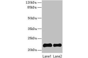 Western blot All lanes: SIRPD antibody at 14 μg/mL Lane 1: 293T whole cell lysate Lane 2: Mouse spleen tissue Secondary Goat polyclonal to rabbit IgG at 1/10000 dilution Predicted band size: 22 kDa Observed band size: 22 kDa (SIRPD antibody  (AA 30-197))