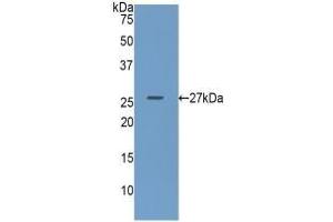 Detection of Recombinant GUSb, Human using Polyclonal Antibody to Glucuronidase Beta (GUSb) (Glucuronidase beta antibody  (AA 451-649))