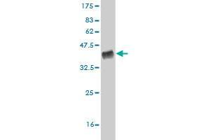 Western Blot detection against Immunogen (32. (SLC29A4 antibody  (AA 283-345))