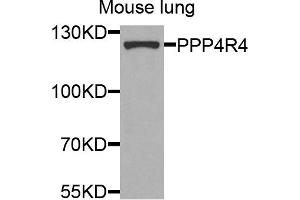 Western blot analysis of extracts of mouse lung cells, using PPP4R4 antibody. (PPP4R4 antibody)