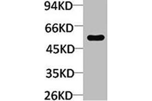 Western blot analysis of Mouse skeletal muscle using TRIM72 Polyclonal Antibody. (TRIM72 antibody)