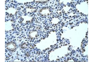 Rabbit Anti-FBP1 Antibody       Paraffin Embedded Tissue:  Human alveolar cell   Cellular Data:  Epithelial cells of renal tubule  Antibody Concentration:   4. (FBP1 antibody  (N-Term))