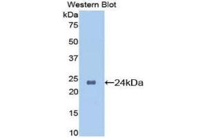 Western Blotting (WB) image for anti-Orosomucoid 1 (ORM1) (AA 19-207) antibody (ABIN3207792) (ORM1 antibody  (AA 19-207))