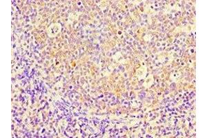Immunohistochemistry of paraffin-embedded human tonsil tissue using ABIN7158664 at dilution of 1:100 (PBK antibody  (AA 1-322))