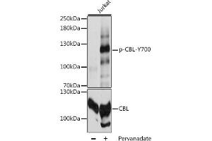 Western blot analysis of extracts of Jurkat cells, using Phospho-CBL-Y700 antibody (ABIN6135196, ABIN6136034, ABIN6136035 and ABIN6225680) at 1:2000 dilution or CBL antibody (ABIN6131302, ABIN6138002, ABIN6138004 and ABIN6213970). (CBL antibody  (pTyr700))