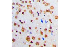 Immunohistochemical analysis of ADAR2 staining in human brain formalin fixed paraffin embedded tissue section. (RED1 antibody  (Center))