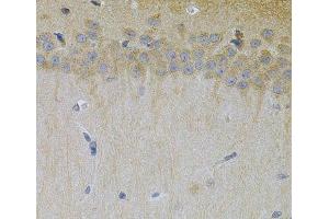 Immunohistochemistry of paraffin-embedded Mouse brain using ERBB3 Polyclonal Antibody at dilution of 1:100 (40x lens). (ERBB3 antibody)
