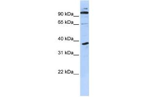 Western Blotting (WB) image for anti-PHD Finger Protein 11 (PHF11) antibody (ABIN2458372) (PHF11 antibody)