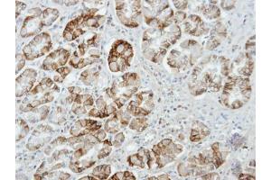 IHC-P Image Immunohistochemical analysis of paraffin-embedded human stomach, using UNC13D, antibody at 1:100 dilution. (UNC13D antibody  (C-Term))