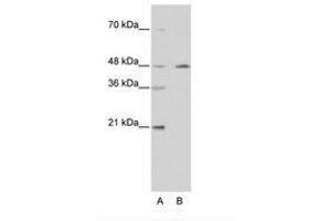Image no. 2 for anti-Nuclear Receptor Subfamily 2, Group F, Member 2 (NR2F2) (AA 141-190) antibody (ABIN6736209) (NR2F2 antibody  (AA 141-190))