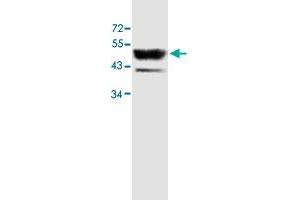 Western blot analysis of human fetal skeletal muscle lysate with ACTL6B polyclonal antibody  at 1 : 500 dilution. (Actin-Like 6B antibody  (AA 178-452))