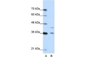 WB Suggested Anti-NKD2 Antibody Titration:  0. (NKD2 antibody  (N-Term))