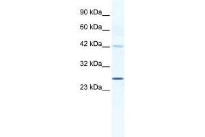 WB Suggested Anti-GJB4 Antibody Titration:  1. (GJB4 antibody  (Middle Region))