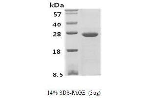 Figure annotation denotes ug of protein loaded and % gel used. (PSPH Protein (AA 1-382) (His tag))