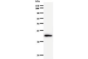 Western Blotting (WB) image for anti-General Transcription Factor IIA, 1, 19/37kDa (GTF2A1) antibody (ABIN931060) (GTF2A1 antibody)