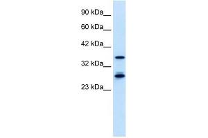 M96 antibody used at 0. (MTF2 antibody  (Middle Region))