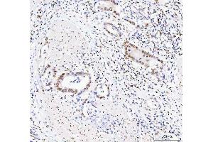 IHC analysis of DDX1 using anti-DDX1 antibody (ABIN7602052). (DDX1 antibody  (AA 562-740))