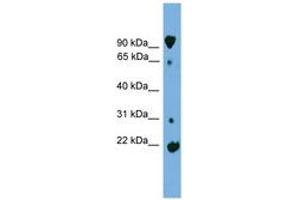 Image no. 1 for anti-Kelch-Like 2, Mayven (KLHL2) (AA 179-228) antibody (ABIN6744966) (KLHL2 antibody  (AA 179-228))