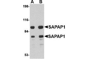 Western Blotting (WB) image for anti-Discs, Large (Drosophila) Homolog-Associated Protein 1 (DLGAP1) (Middle Region) antibody (ABIN1031076) (DLGAP1 antibody  (Middle Region))