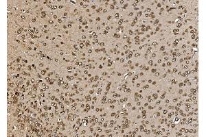 IHC analysis of Proteasome 20S Beta 7/PSMB7 using anti-Proteasome 20S Beta 7/PSMB7 antibody (ABIN7600256).