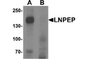 Western blot analysis of LNPEP in human lung tissue lysate with LNPEP Antibody  at 1 ug/mL in (A) the absence and (B) the presence of blocking peptide. (LNPEP antibody  (C-Term))