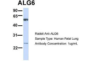 Host:  Rabbit  Target Name:  ALG6  Sample Type:  Human Fetal Lung  Antibody Dilution:  1. (ALG6 antibody  (N-Term))