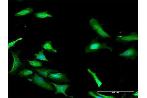 Immunofluorescence of purified MaxPab antibody to PDCD2 on HeLa cell. (PDCD2 antibody  (AA 1-344))