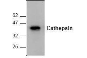 Image no. 1 for anti-Cathepsin K (CTSK) antibody (ABIN155107) (Cathepsin K antibody)