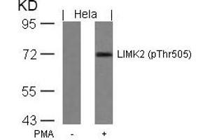 Western blot analysis of extracts from Hela cells untreated or treated with PMA using LIMK2(Phospho-Thr505) Antibody. (LIMK2 antibody  (pThr505))