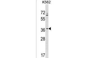 ZNF385A Antibody (N-term) (ABIN1539472 and ABIN2849352) western blot analysis in K562 cell line lysates (35 μg/lane). (ZNF385A antibody  (N-Term))