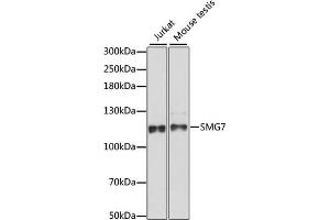 Western blot analysis of extracts of various cell lines, using SMG7 antibody (ABIN7270376) at 1:1000 dilution. (SMG7 antibody  (AA 1-300))