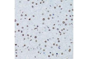 Immunohistochemistry (Paraffin-embedded Sections) (IHC (p)) image for anti-Nuclear Factor of kappa Light Polypeptide Gene Enhancer in B-Cells 2 (NFKB2) (AA 690-899) antibody (ABIN3017388)