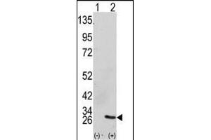 Western blot analysis of GRB2 (arrow) using GRB2 Antibody (Center) (ABIN390238 and ABIN2840708). (GRB2 antibody  (AA 89-118))