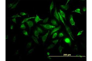 Immunofluorescence of monoclonal antibody to RAB3B on HeLa cell. (RAB3B antibody  (AA 120-219))
