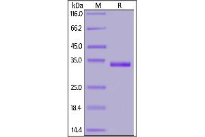 SARS-CoV-2 S protein RBD (W436R), His Tag on SDS-PAGE under reducing (R) condition.