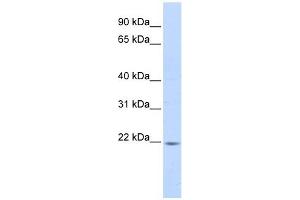 PPIB antibody used at 1 ug/ml to detect target protein. (PPIB antibody)