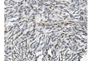 IHC analysis of NHEJ1 using anti-NHEJ1 antibody (ABIN7599198). (NHEJ1 antibody  (AA 1-273))