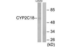 Western blot analysis of extracts from LOVO cells, using Cytochrome P450 2C8/9/18/19 Antibody. (Cytochrome P450 2C8/9/18/19 (AA 111-160) antibody)
